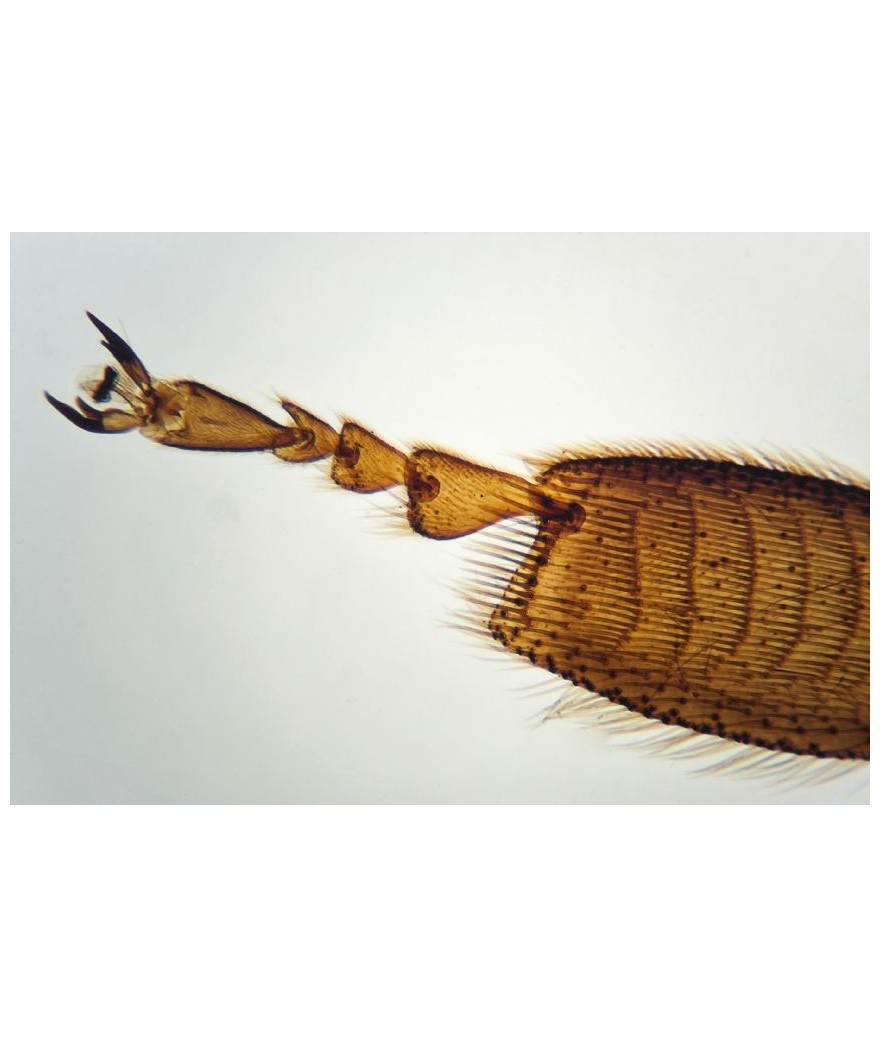 Brainstorm - outdoor microscope