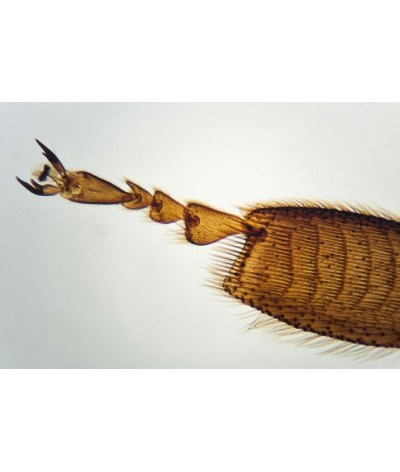 Brainstorm - outdoor microscope